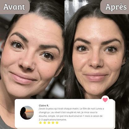 Lunisse™ – Pelle più liscia già al risveglio