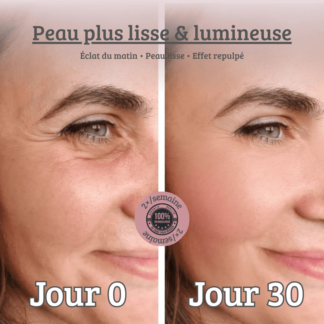 Lunisse™ – Pelle più liscia già al risveglio